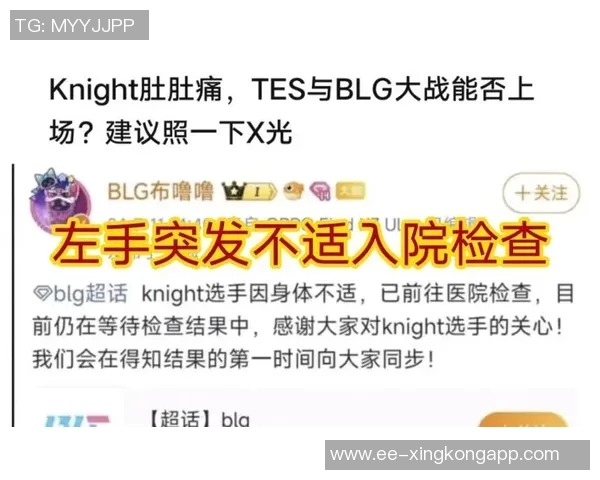 文班MRI检查结果无韧带损伤步行者缺阵开拓者出战成疑引发关注